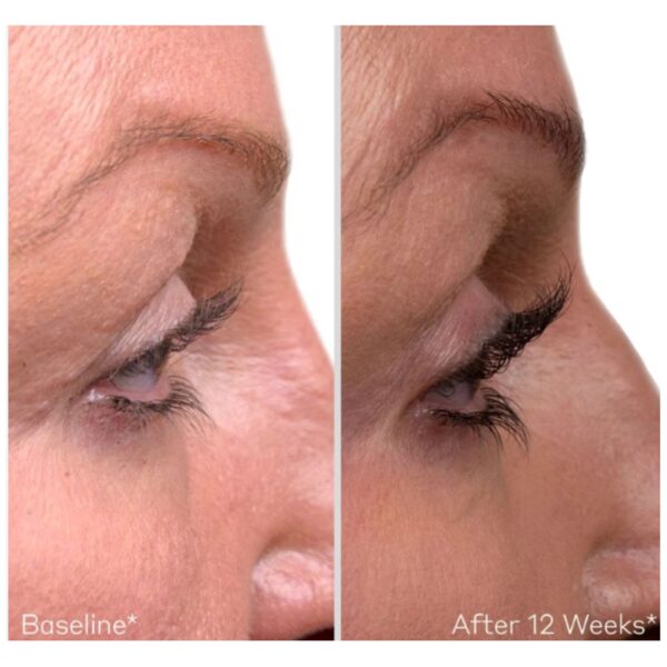 Obagi Nu-Cil™ Eyelash + Eyebrow - Image 3